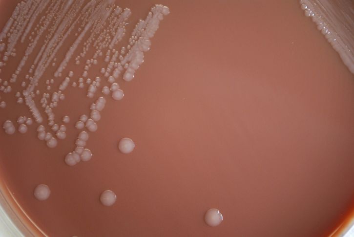 LES PLAIES ET LES MALADIES INFECTIEUSES ÉMERGENTES SONT-ELLES PROPHÉTIQUES ?